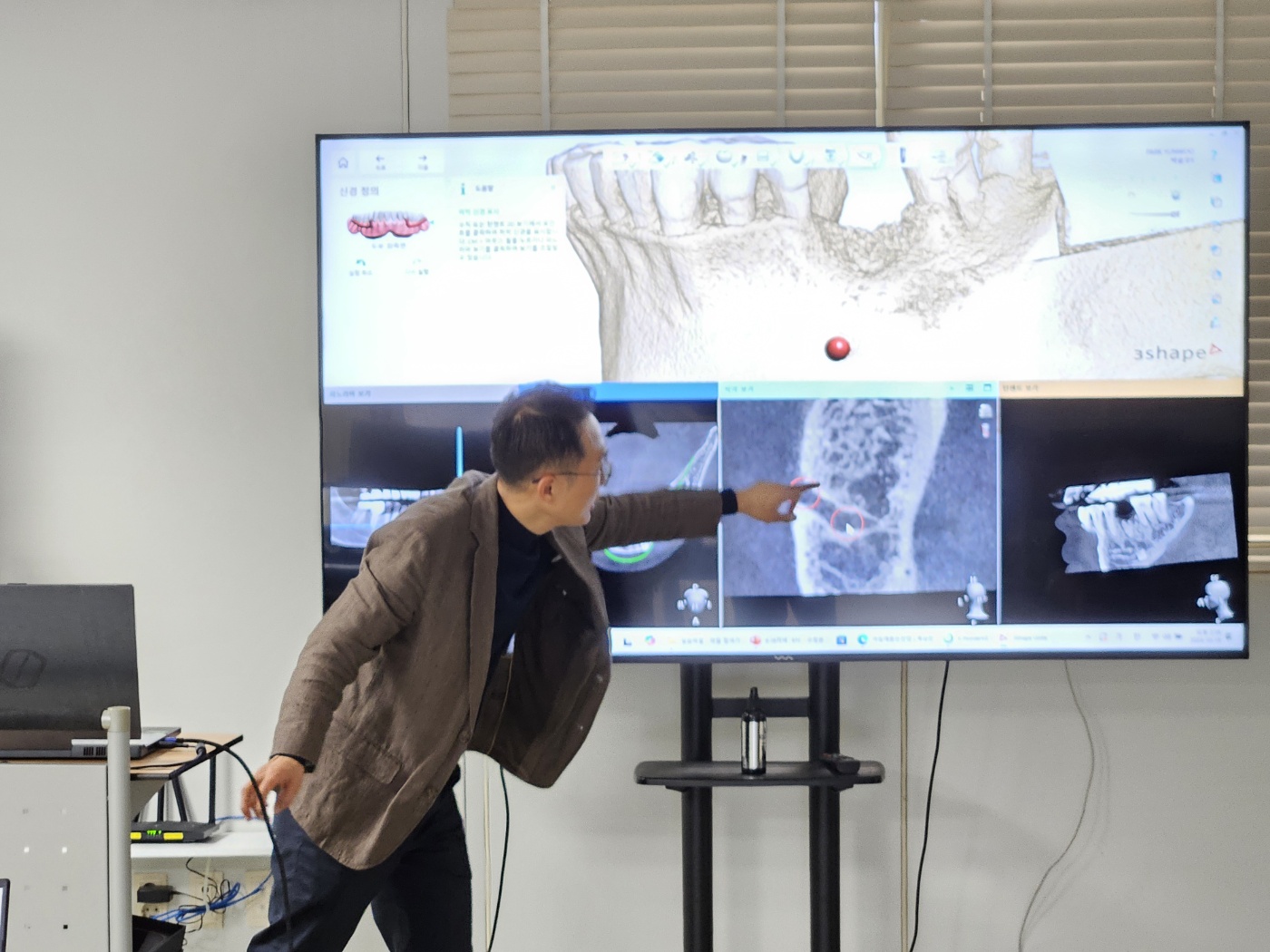 박윤우 3shape CT 분석 강의